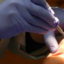 Orthodontie : quel appareil choisir pour votre enfant